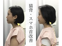 リバティ 世田谷代田整体院(Liberty)/肩甲骨はがしでスマホ首改善
