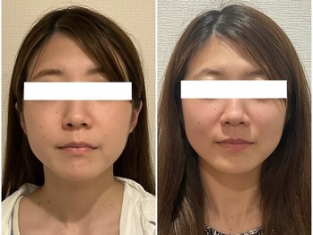 美容整体 ウェリナ 蟹江院/小顔矯正/骨盤矯正/美脚サロン