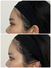 ルミア(LUMIA)/20代／顔の立体感がもっと欲しい