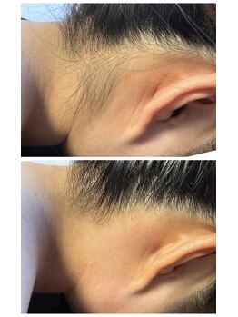 エステアンドネイル ファーシル(Esthe & Nail Facil)の写真/ &nbsp;&nbsp;&nbsp;WAXと光の組み合わせで、ワンランク上のうなじケア。