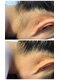エステアンドネイル ファーシル(Esthe & Nail Facil)の写真/ &nbsp;&nbsp;&nbsp;WAXと光の組み合わせで、ワンランク上のうなじケア。