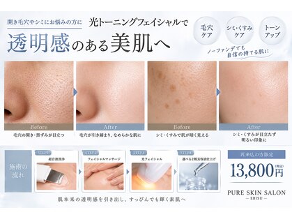 ピュアスキンサロン 恵比寿店(pure skin salon)の写真