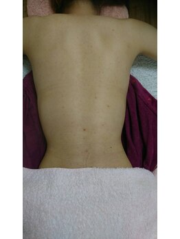 サロンエム(Salon m)/背中エステ