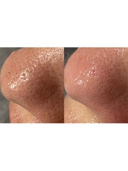 メゾン ド エム(maison de M)/