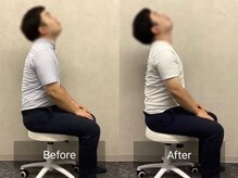 博多おかげ整体院/整体＆姿勢矯正ビフォーアフター