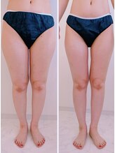 アンドモア(&more)/お写真撮影して変化を確認！