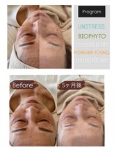 エイティ(Atey)/肌質改善プログラム