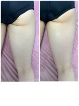 アスピリア(aspirer a')/下半身スッキリ！