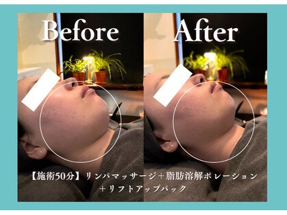 ヒトヒ(HITOHI)の写真