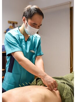 金町5丁目鍼灸マッサージ院/鍼灸施術の様子