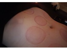 アール ピースア(R pii-suer)/カッピング/タイ古式マッサージ