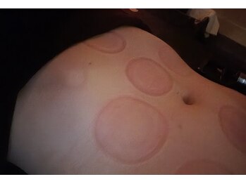 アール ピースア(R pii-suer)/カッピング/タイ古式マッサージ