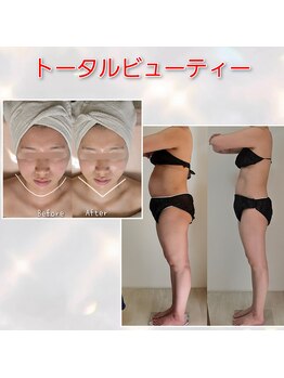 ラエッセス(A Laessess)の写真/ブライダルエステで叶う！肌質・ボディ改善に自信あり◎短期間で理想の自分へ★
