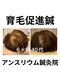 アンスリウム美容整体院 鍼灸院 接骨院の写真/頭皮環境を根本から整え、鍼で強く太い髪へ導く！巡りが変わりボリュームアップで鏡を見るのも楽しくなる◎