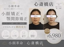 小顔革命 心斎橋