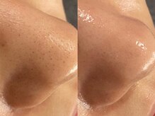 メゾン ド エム(maison de M)/