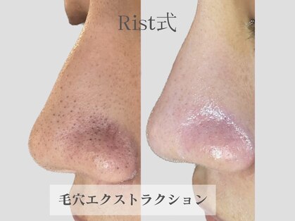 リスト(Rist TOTAL BEAUTY)の写真