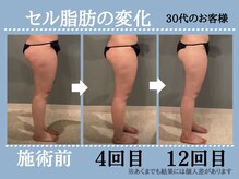 ボディエステティック アクアオーラ 高岡店/