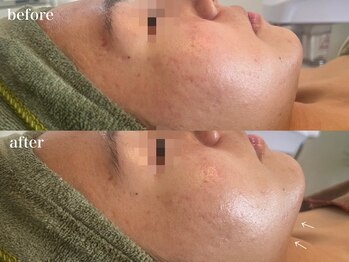 リボーン 浜松(reborn)/