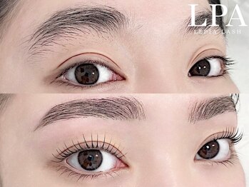 レピア 仙台店/韓国式LEPIA Before&Aｆter