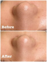 サロンリエム(Salon Riem.)/【ハーブトリートメント】