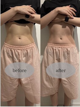 マホロバ セカンド(mahoroba 2nd)/EMSプラス腸活マッサージ