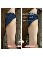 ラフ(laugh)/『キュッ』大きいお尻さようなら