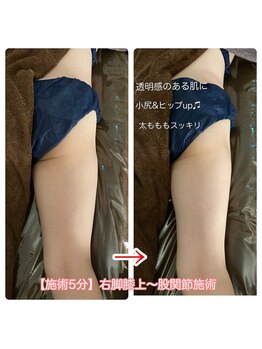 ラフ(laugh)/『キュッ』大きいお尻さようなら