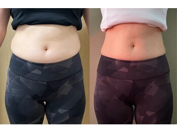 マイティー整骨院 ココア(CoCoa)/ハイブリッドトレーニング