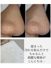 エクラーレ(Eclale)/【毛穴ケア】症例