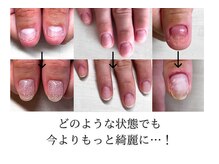 ヴェールリム(verl lim)の雰囲気（即日見た目改善かつ、一定期間の集中プログラムで美爪を目指す！）