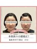 ◆小顔矯正◆セット割500円オフ