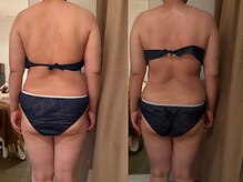 ビーグレイス(Vigrace)/ハイパーナイフ/シェイプ