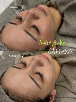 クレビア(CREBIA)/くすみ、赤み、ゆらぎ肌の方は…