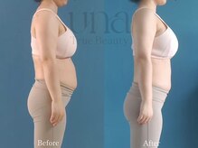 ウナ 西中島店(UNA)/効果◎オンダプロフェッショナル