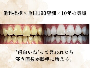 ホワイトニングショップ 八王子店