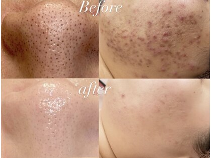 レシェルサロン(Lechelle Salon)の写真