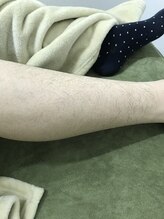 ナノハナ/鹿沼市全身脱毛ナノハナ