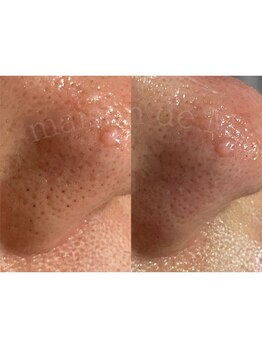 メゾン ド エム(maison de M)/