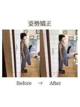 心斎橋長堀フェムテック整骨院/20姿勢矯正　骨格矯正と骨盤矯正