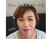 シェアキ(Chez Aki)/光フェイシャル/左右比較