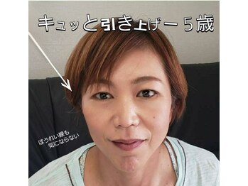 シェアキ(Chez Aki)/光フェイシャル/左右比較