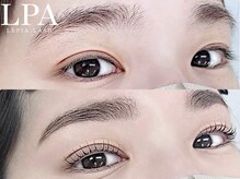 レピア 仙台店/韓国式LEPIA Before&Aｆter