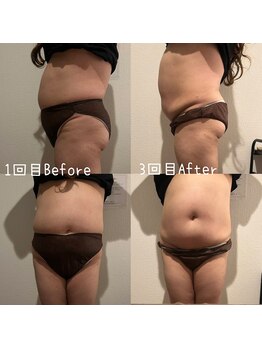 サロン ド モミカル(salon de momikaru)/