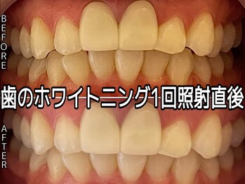 ヴィオール 名古屋栄店(VIOR)/歯周・虫歯予防♪