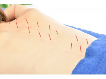 えんじゅく整骨院/肩こり、腰痛に!