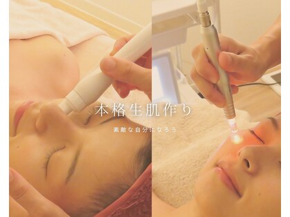 ジョイラックス(Joylax)の写真