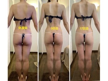 エステティックジュネス(JEUNESSE)/シークレットボディ120分