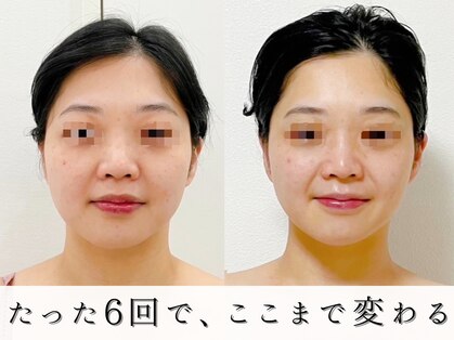 ジョンミー(JONMEE)の写真