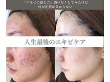 エピア 三河安城店(Epia)